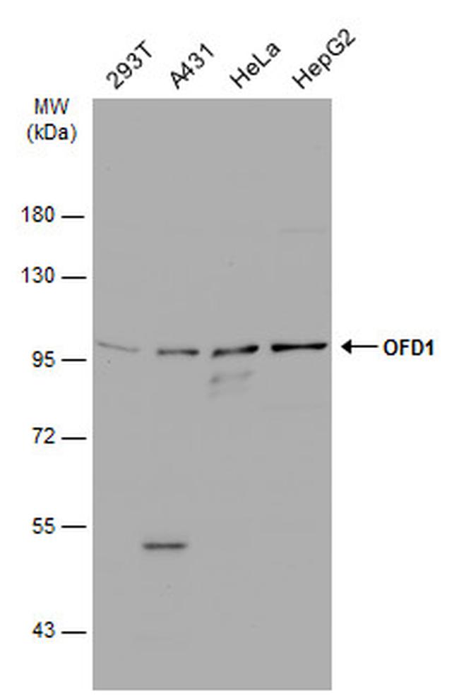 OFD1 Antibody in Western Blot (WB)