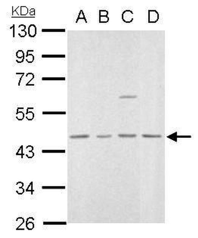 MVD Antibody in Western Blot (WB)
