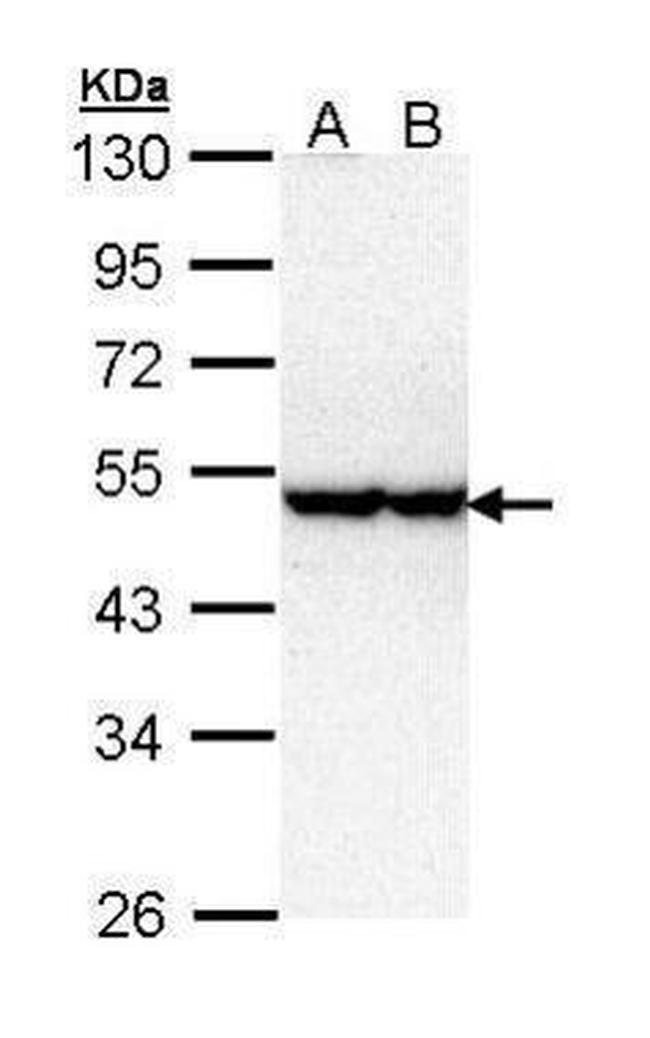 STK40 Antibody in Western Blot (WB)