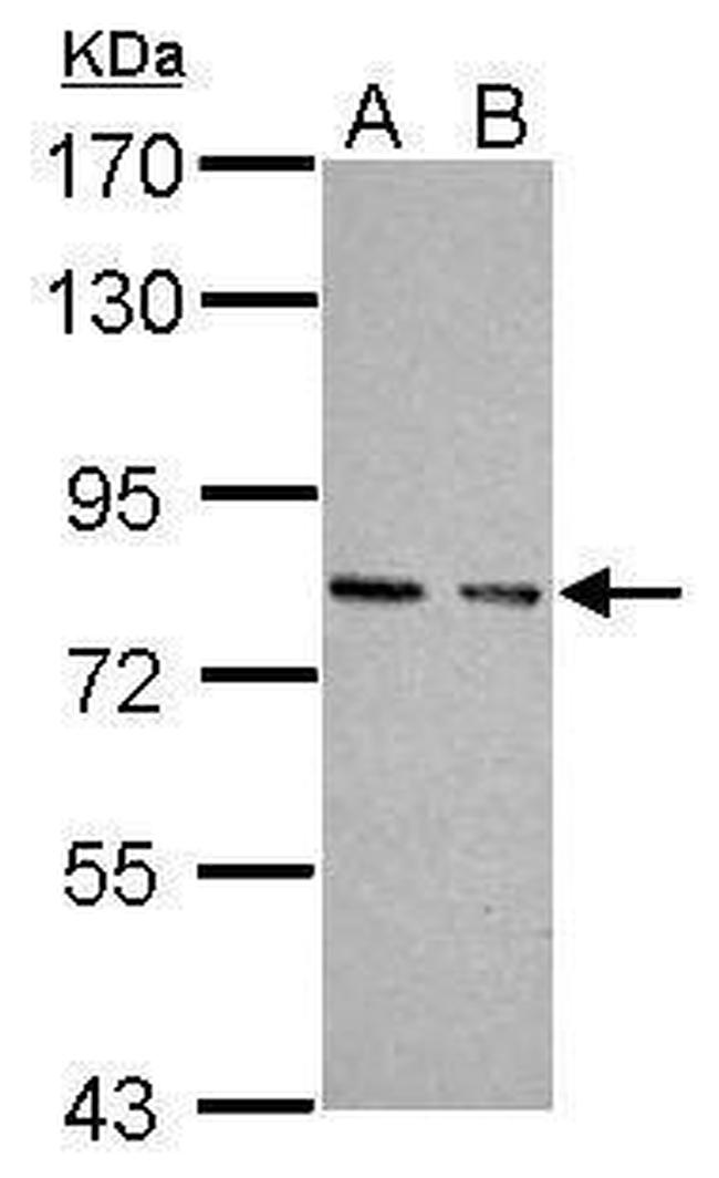 cGKI Antibody in Western Blot (WB)