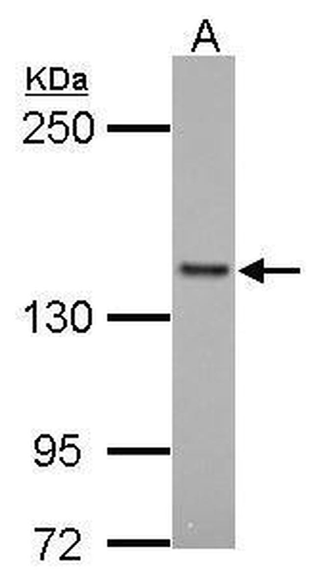 FMNL1 Antibody in Western Blot (WB)