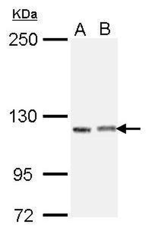 IGSF3 Isoform 2 Antibody in Western Blot (WB)
