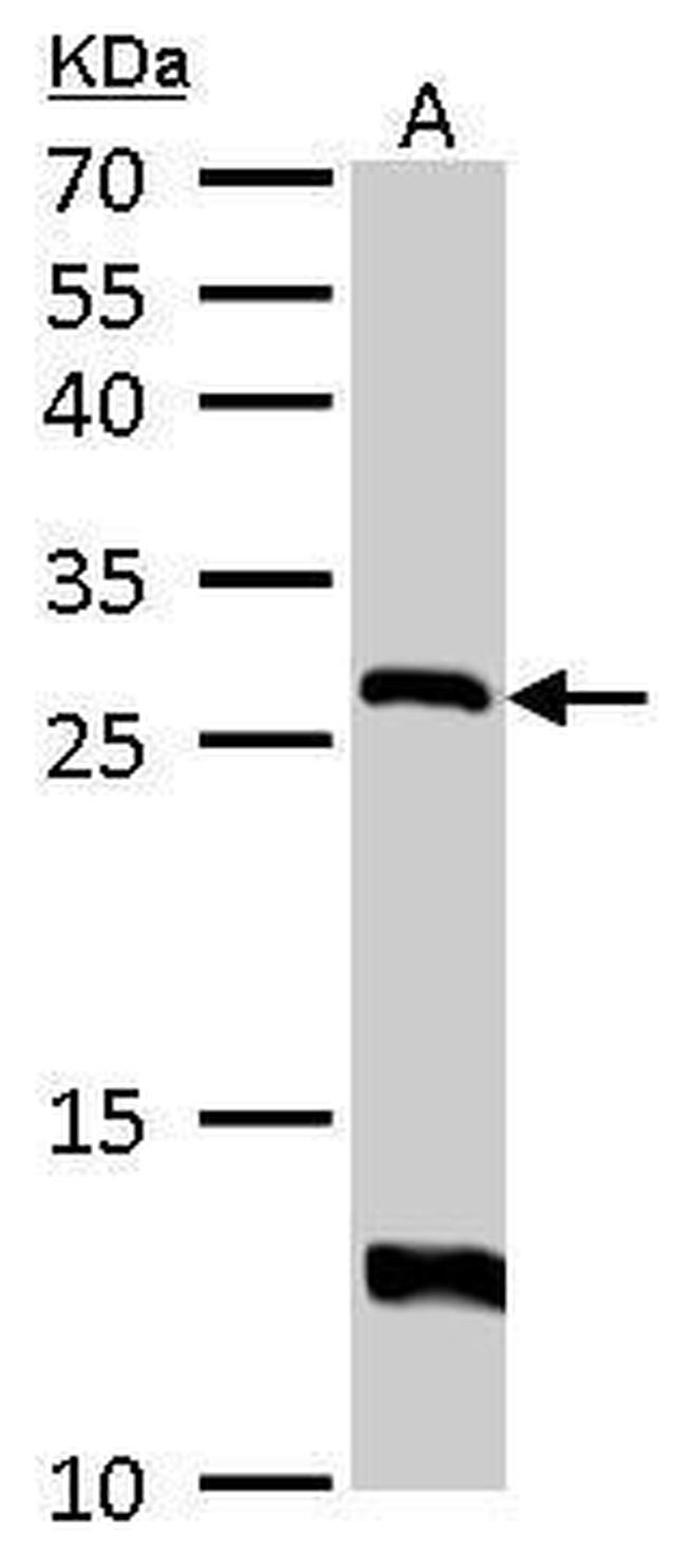 HPRT1 Antibody in Western Blot (WB)