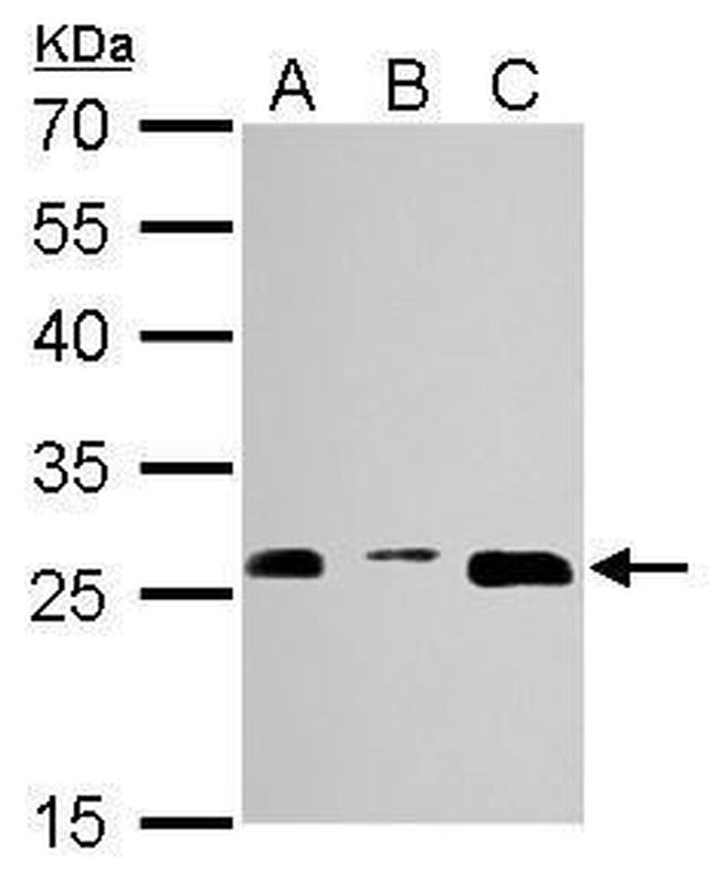 PSMA3 Antibody in Western Blot (WB)