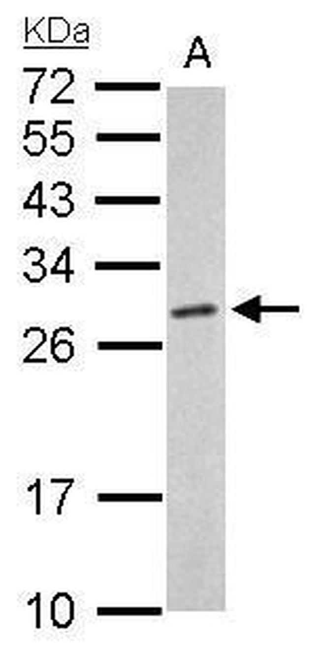 PSMA6 Antibody in Western Blot (WB)