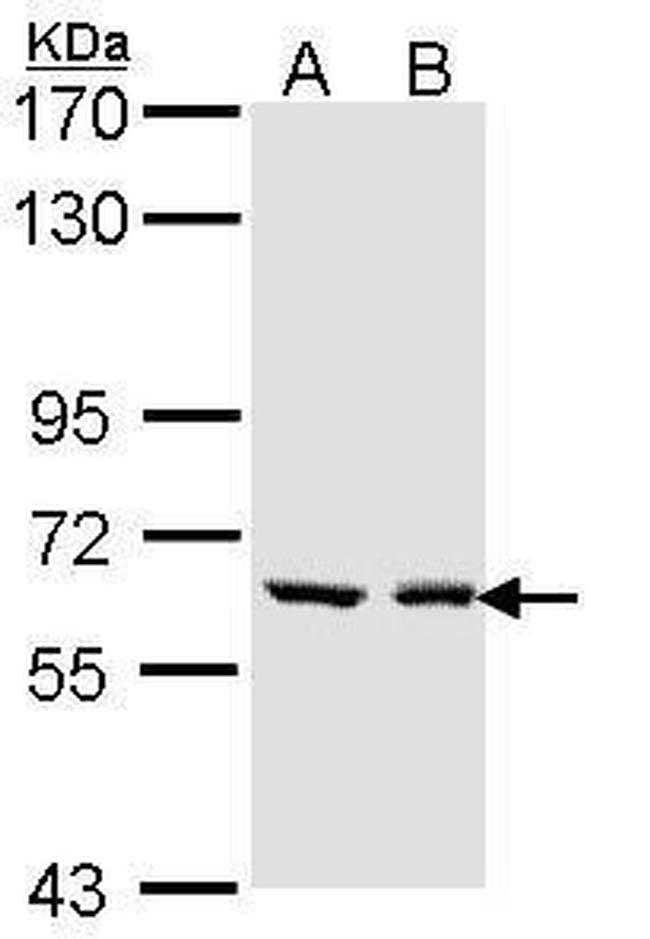 UGT1A6 Antibody in Western Blot (WB)