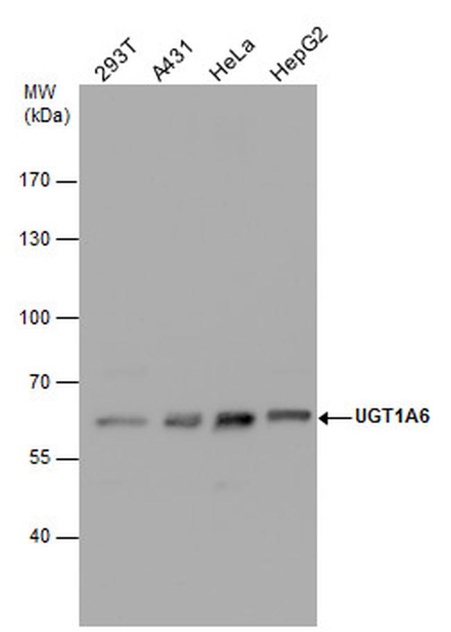 UGT1A6 Antibody in Western Blot (WB)