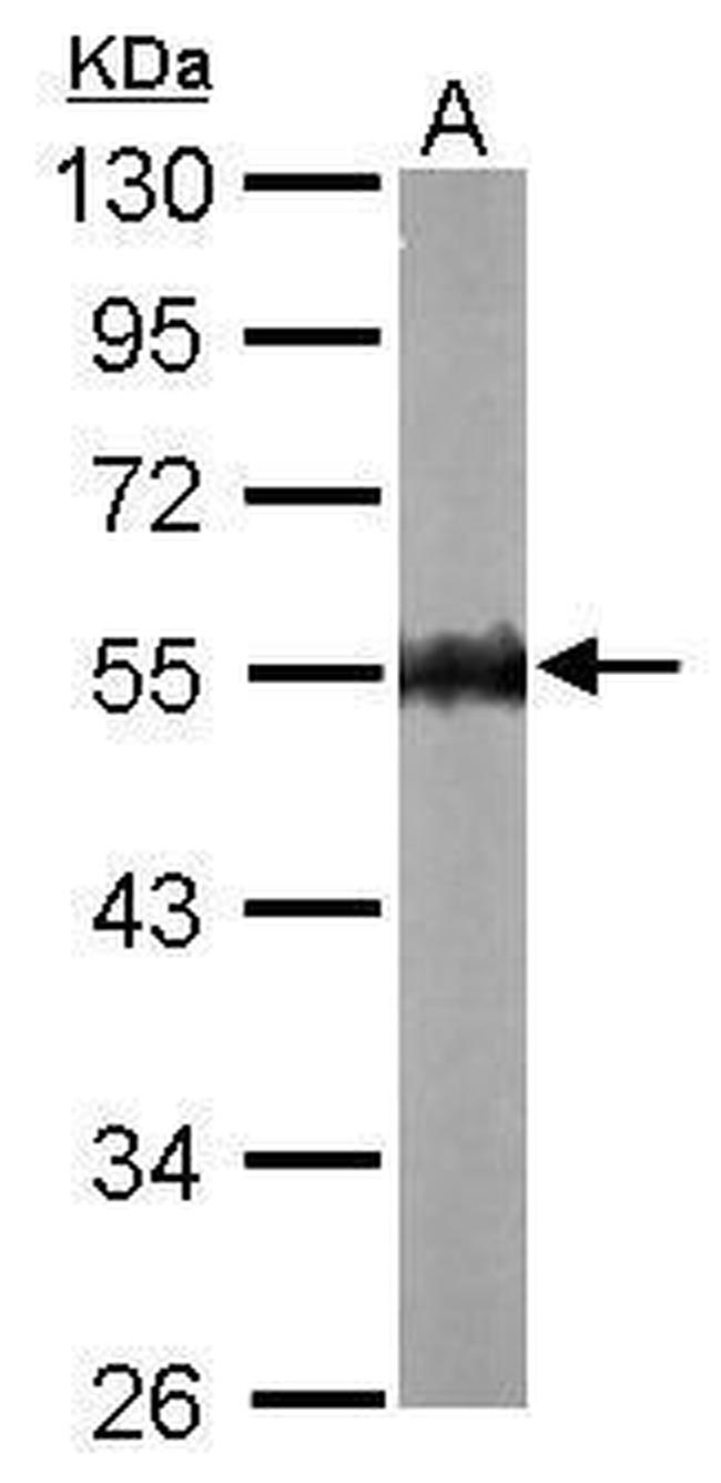 AMPK gamma-2 Antibody in Western Blot (WB)