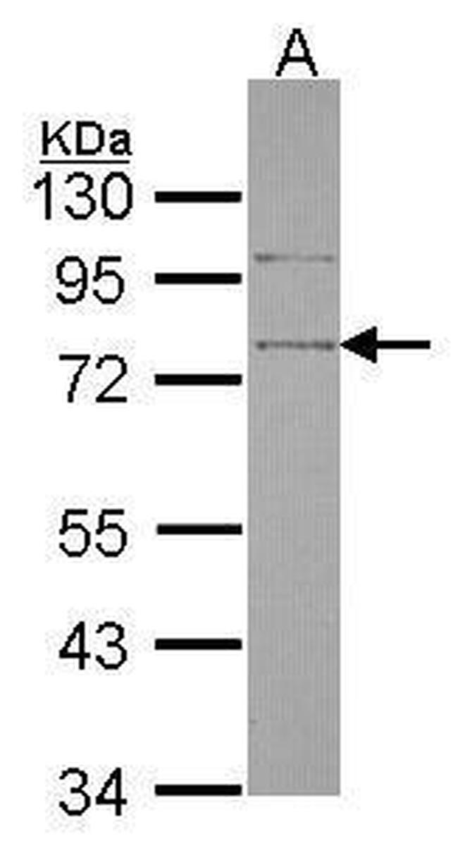 SRPX Antibody in Western Blot (WB)