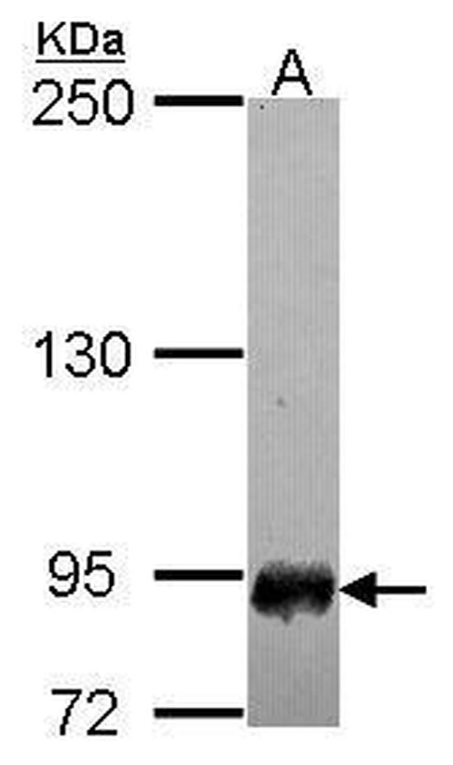SFMBT1 Antibody in Western Blot (WB)