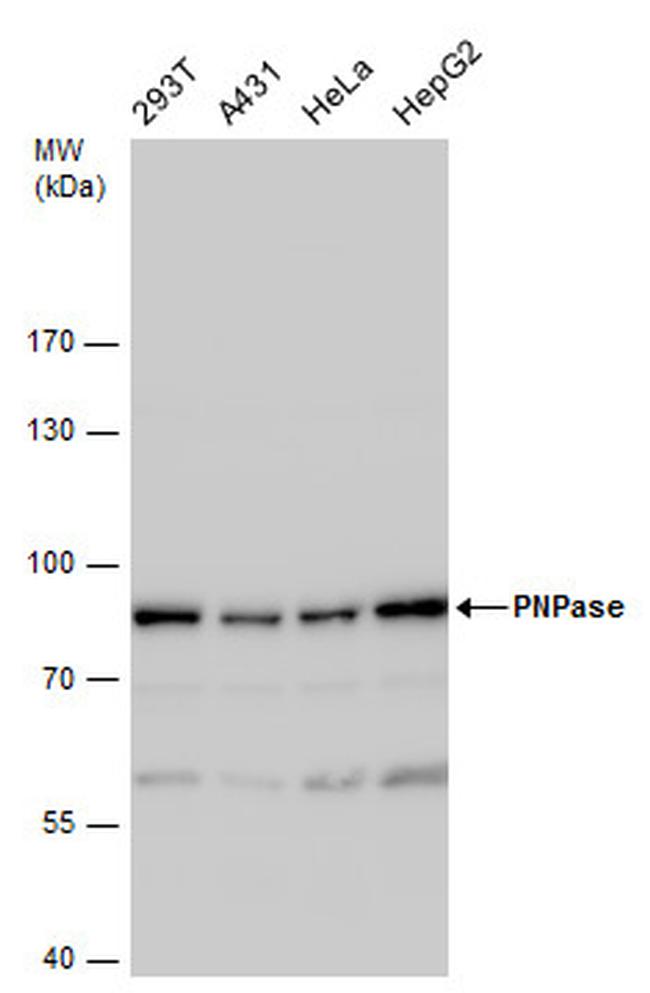 PNPase Antibody in Western Blot (WB)