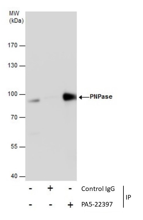 PNPase Antibody in Immunoprecipitation (IP)