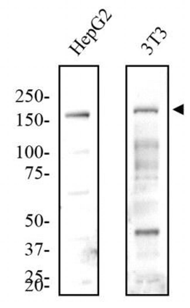 JMJD3 Antibody in Western Blot (WB)