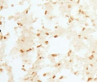 RCAN1 Antibody in Immunohistochemistry (Paraffin) (IHC (P))
