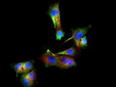 PINK1 Antibody in Immunocytochemistry (ICC/IF)