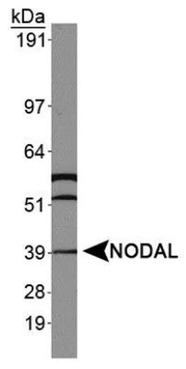 Nodal Antibody in Western Blot (WB)