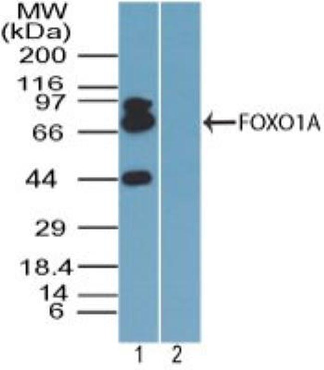FOXO1 Antibody in Western Blot (WB)