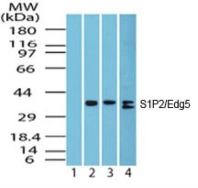 S1PR2 Antibody in Western Blot (WB)
