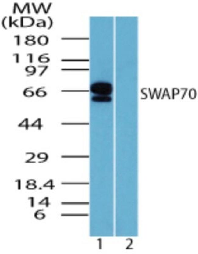 SWAP70 Antibody in Western Blot (WB)