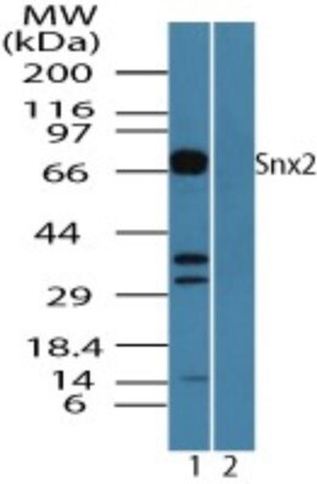SNX2 Antibody in Western Blot (WB)