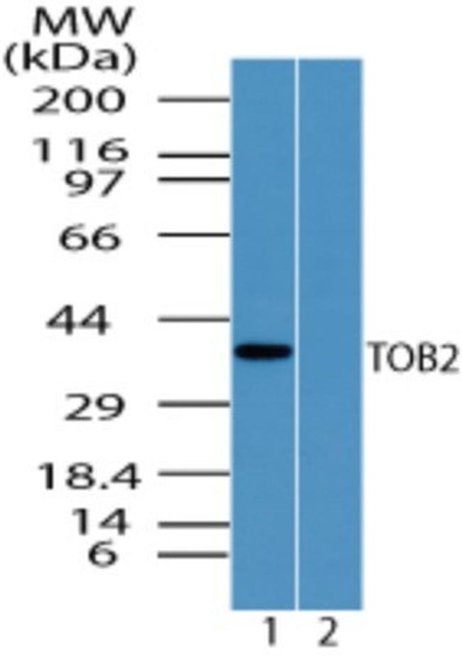TOB2 Antibody in Western Blot (WB)