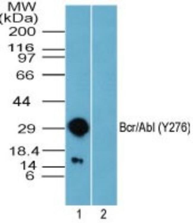 Phospho-BCR (Tyr276) Antibody in Western Blot (WB)