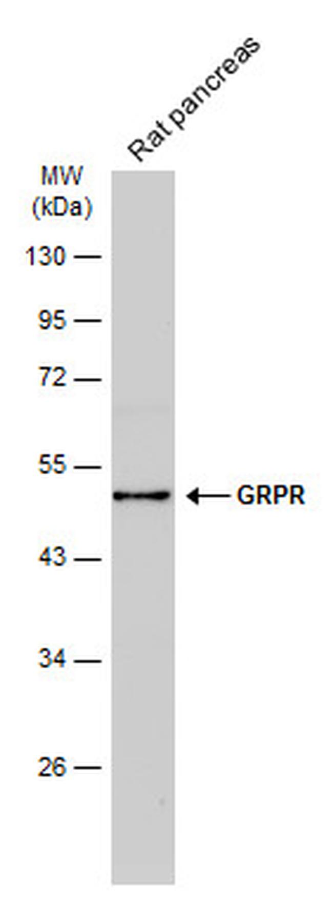 GRPR Antibody in Western Blot (WB)