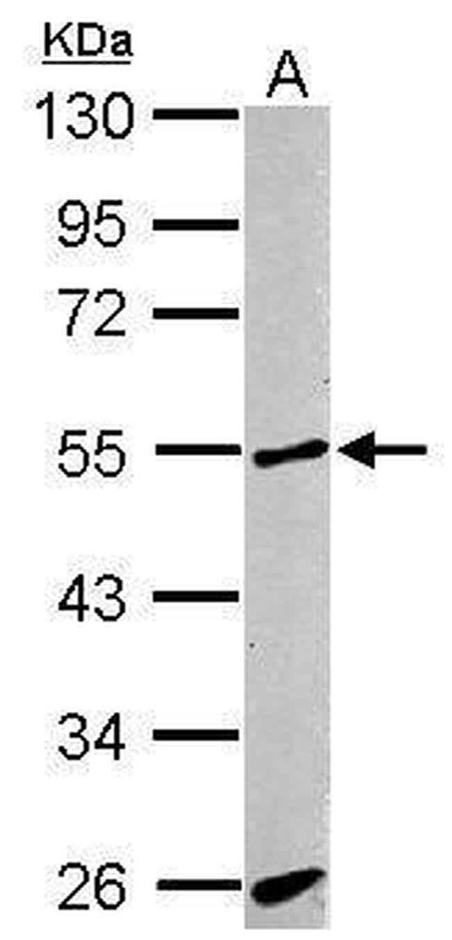 ACVRL1 Antibody in Western Blot (WB)