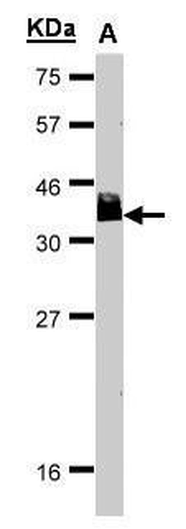 BCL7A Antibody in Western Blot (WB)
