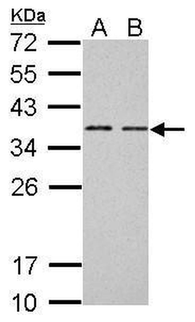 BCL7A Antibody in Western Blot (WB)