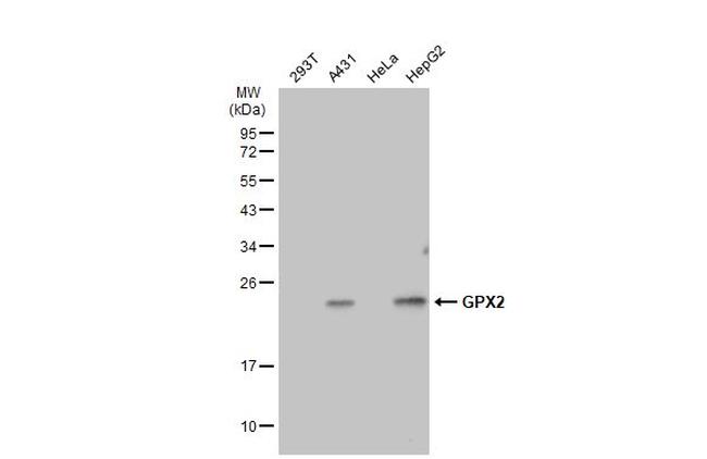 GPX2 Antibody in Western Blot (WB)