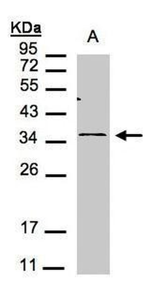 CXCR6 Antibody in Western Blot (WB)