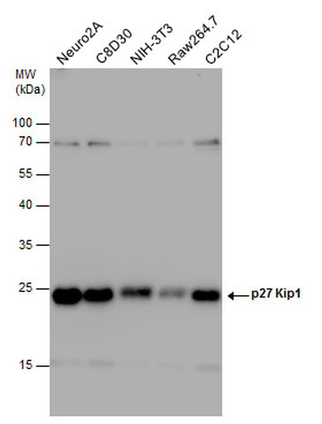 p27 Kip1 Antibody in Western Blot (WB)