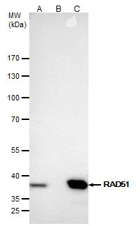 RAD51 Antibody in Immunoprecipitation (IP)