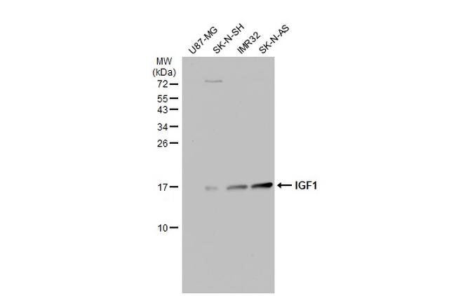 IGF1 Antibody in Western Blot (WB)