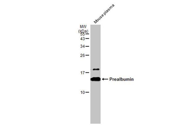 Transthyretin Antibody in Western Blot (WB)
