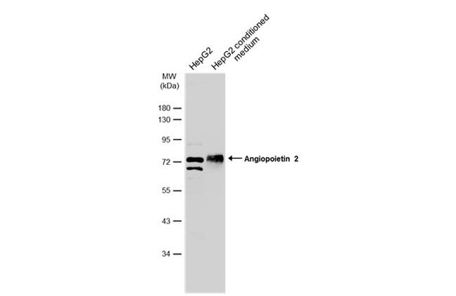 Angiopoietin 2 Antibody in Western Blot (WB)