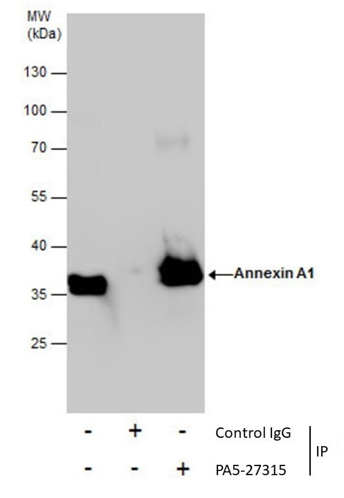 Annexin A1 Antibody in Immunoprecipitation (IP)