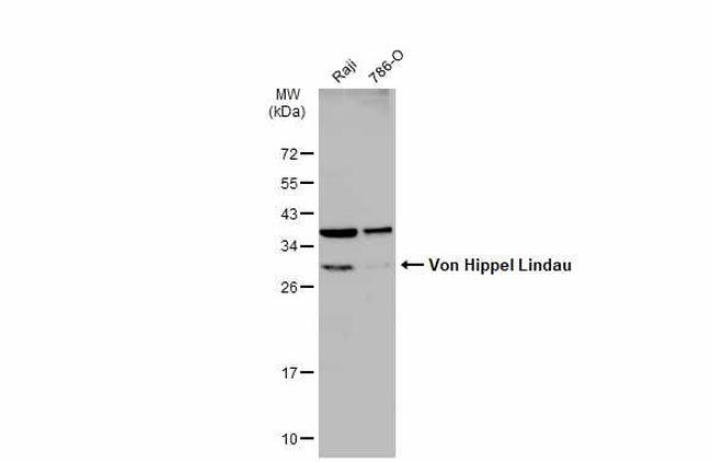 VHL Antibody in Western Blot (WB)