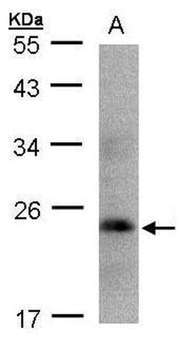 Growth Hormone Antibody in Western Blot (WB)