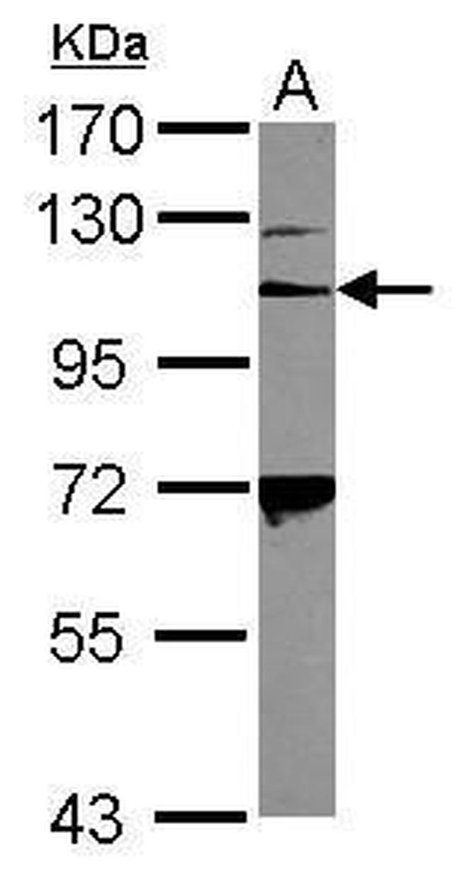 CD41 Antibody in Western Blot (WB)