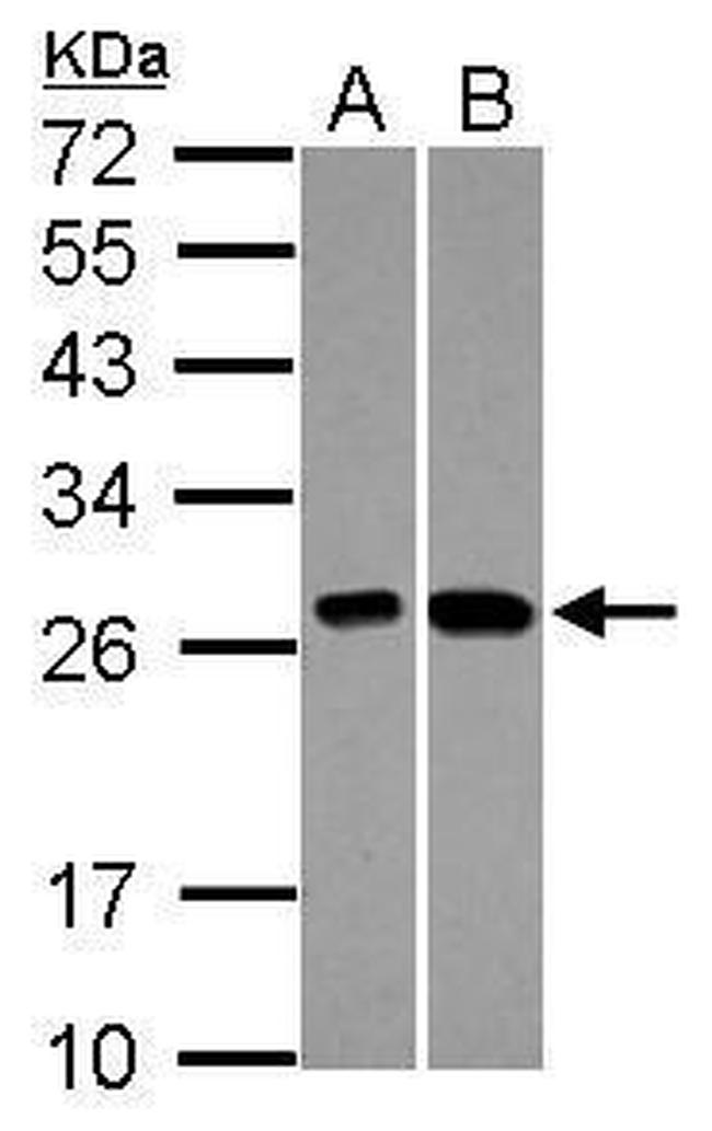 KNP-I Antibody in Western Blot (WB)