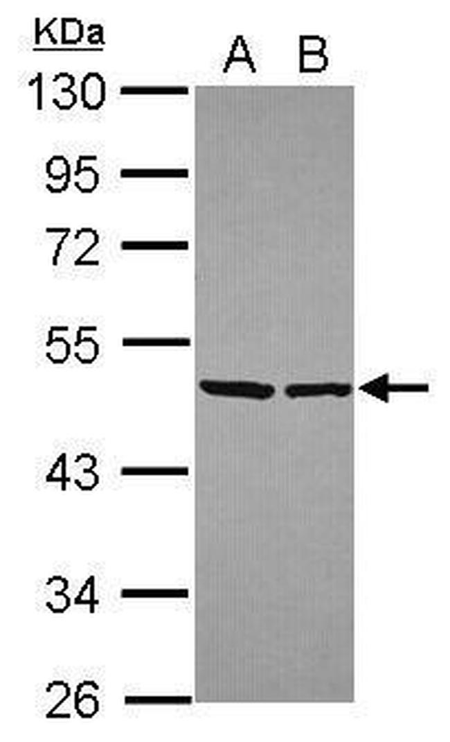 eIF4A2 Antibody in Western Blot (WB)