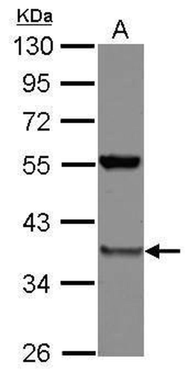 PSMD8 Antibody in Western Blot (WB)