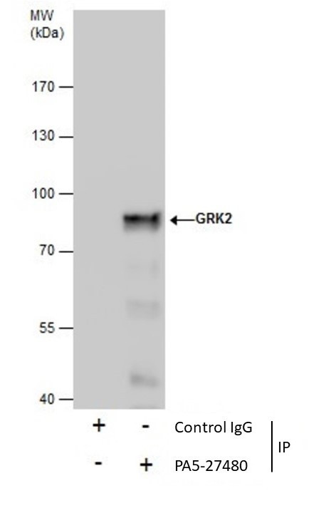 GRK2 Antibody in Immunoprecipitation (IP)
