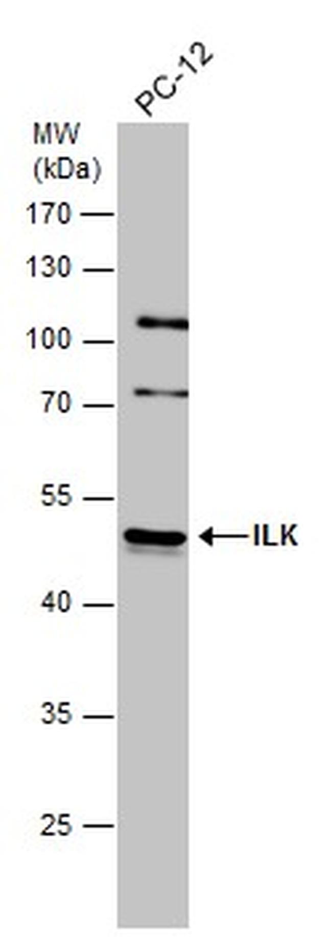 ILK Antibody in Western Blot (WB)