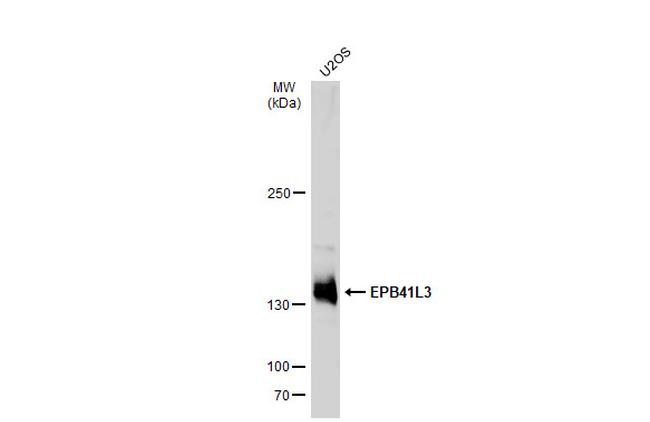 EPB41L3 Antibody in Western Blot (WB)