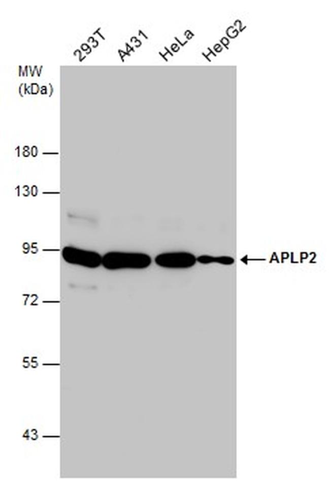 APLP2 Antibody in Western Blot (WB)