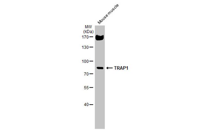 TRAP1 Antibody in Western Blot (WB)