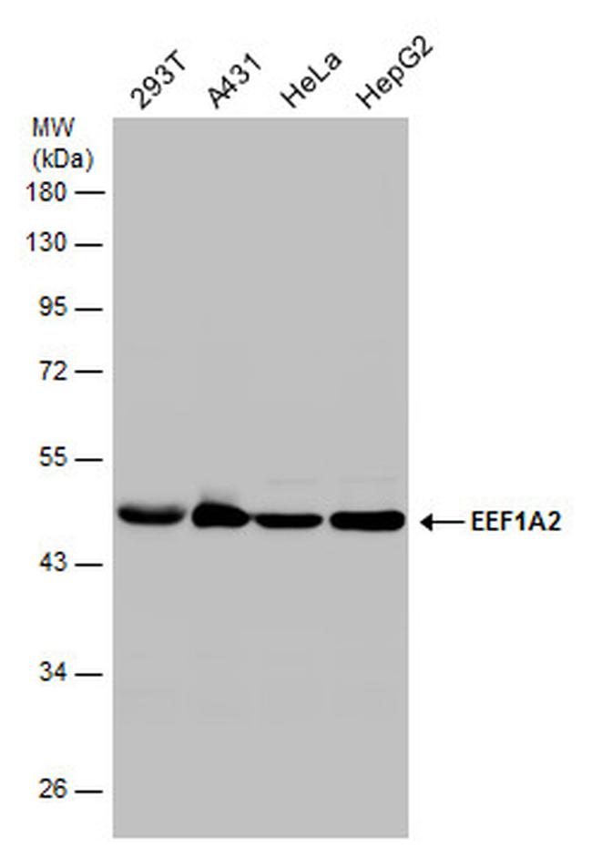 EEF1A2 Antibody in Western Blot (WB)